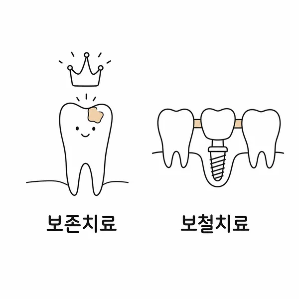 보존치료와 보철치료를 나란히 비교한 치아보험 구조 설명 그림
